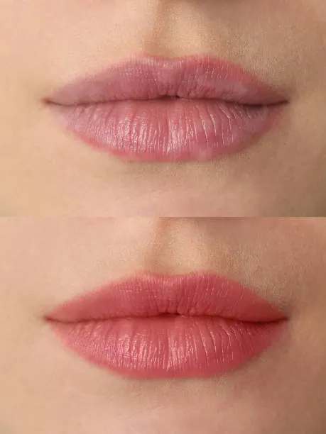 Før og efter permanent makeup til læber