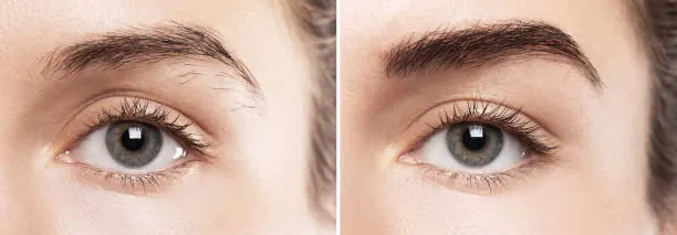 Illustration af bryn før og efter microblading