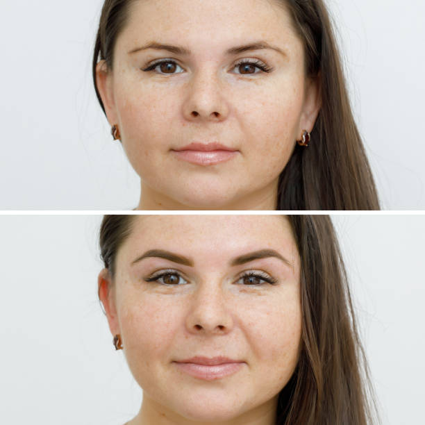 Før og efter combination brows behandling