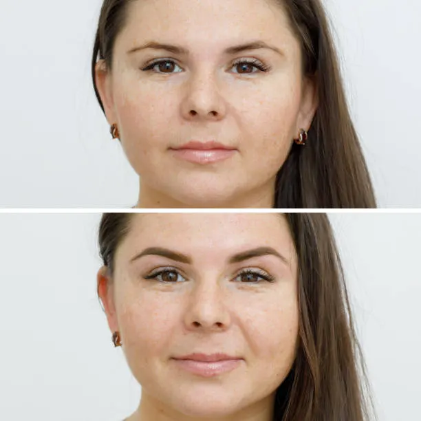 Illustration af bryn før og efter combination brows